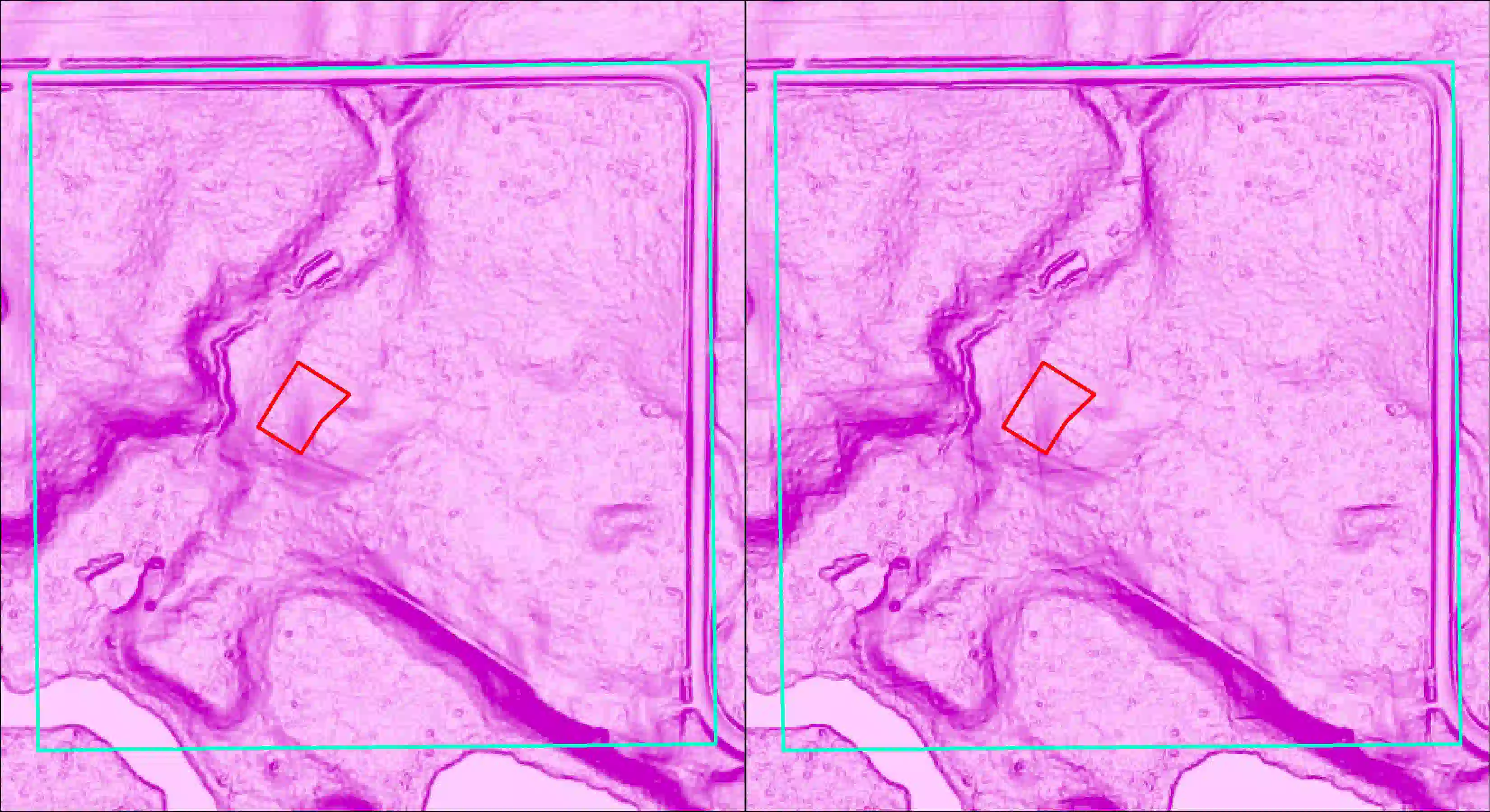 A side-by-side comparison of two slope rasters derived from different resampling techniques. Steeper slopes are darker pint and flatter slopes lighter pink. Property boundary in turquoise outline and orchard in red outline.